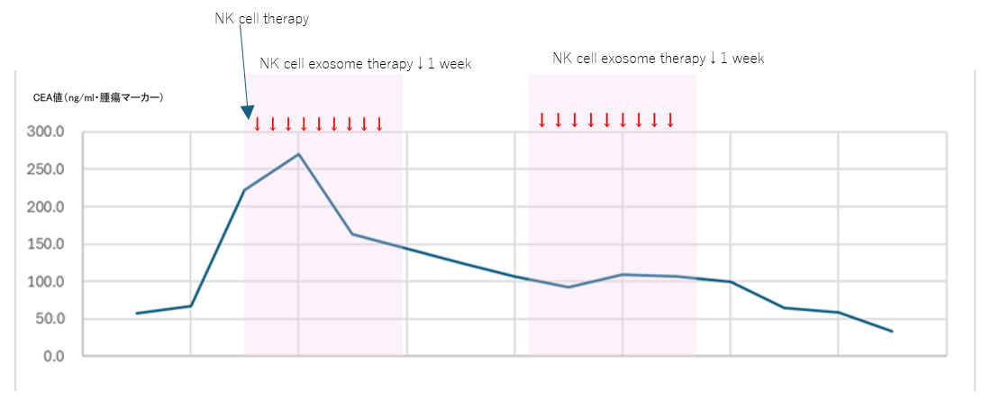 1. Autologous NK cell + allogeneic NK cell exosome combination therapy